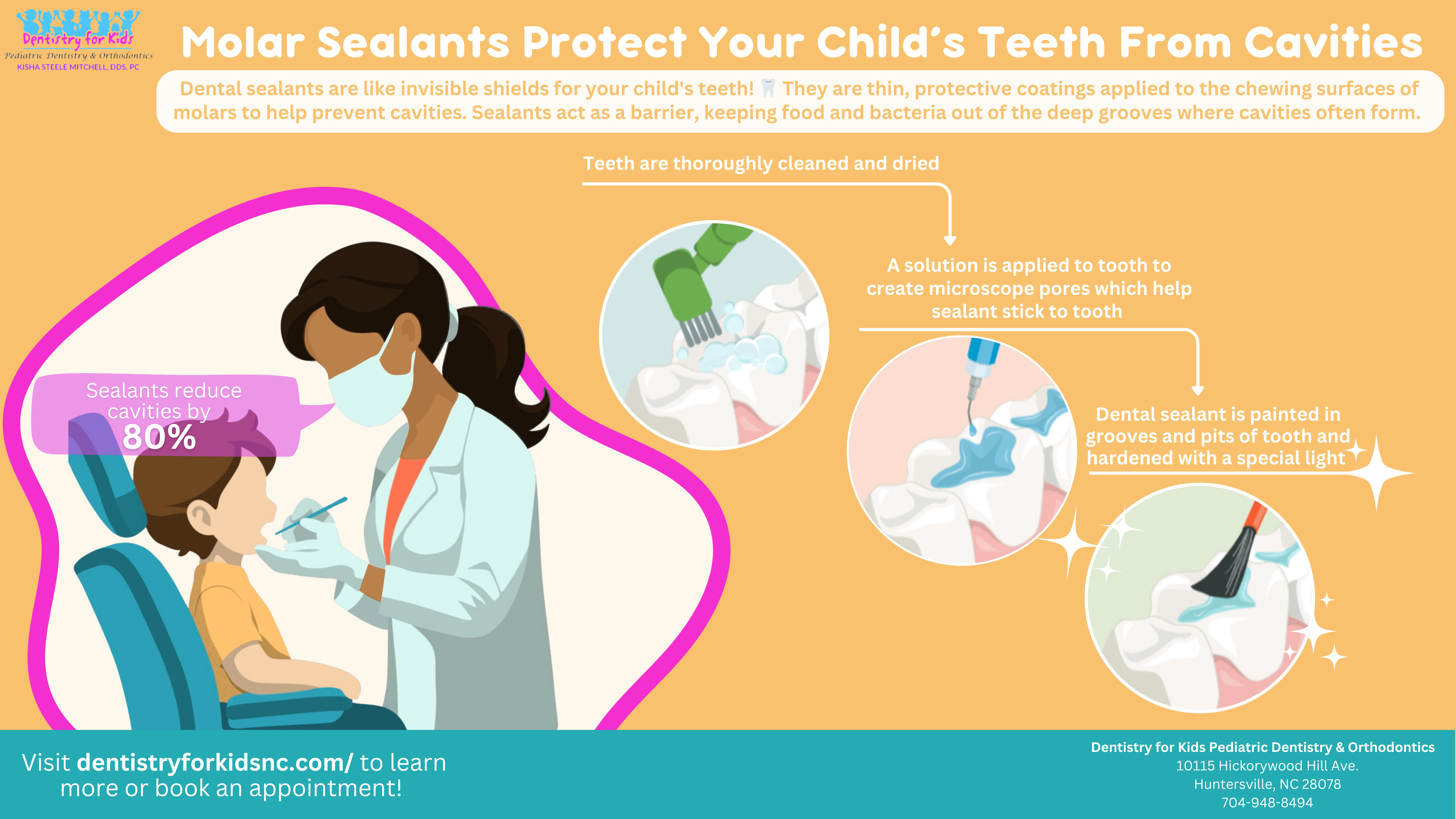 infographic with information about dental sealants with a three part image of dental sealants are applied to molars. 