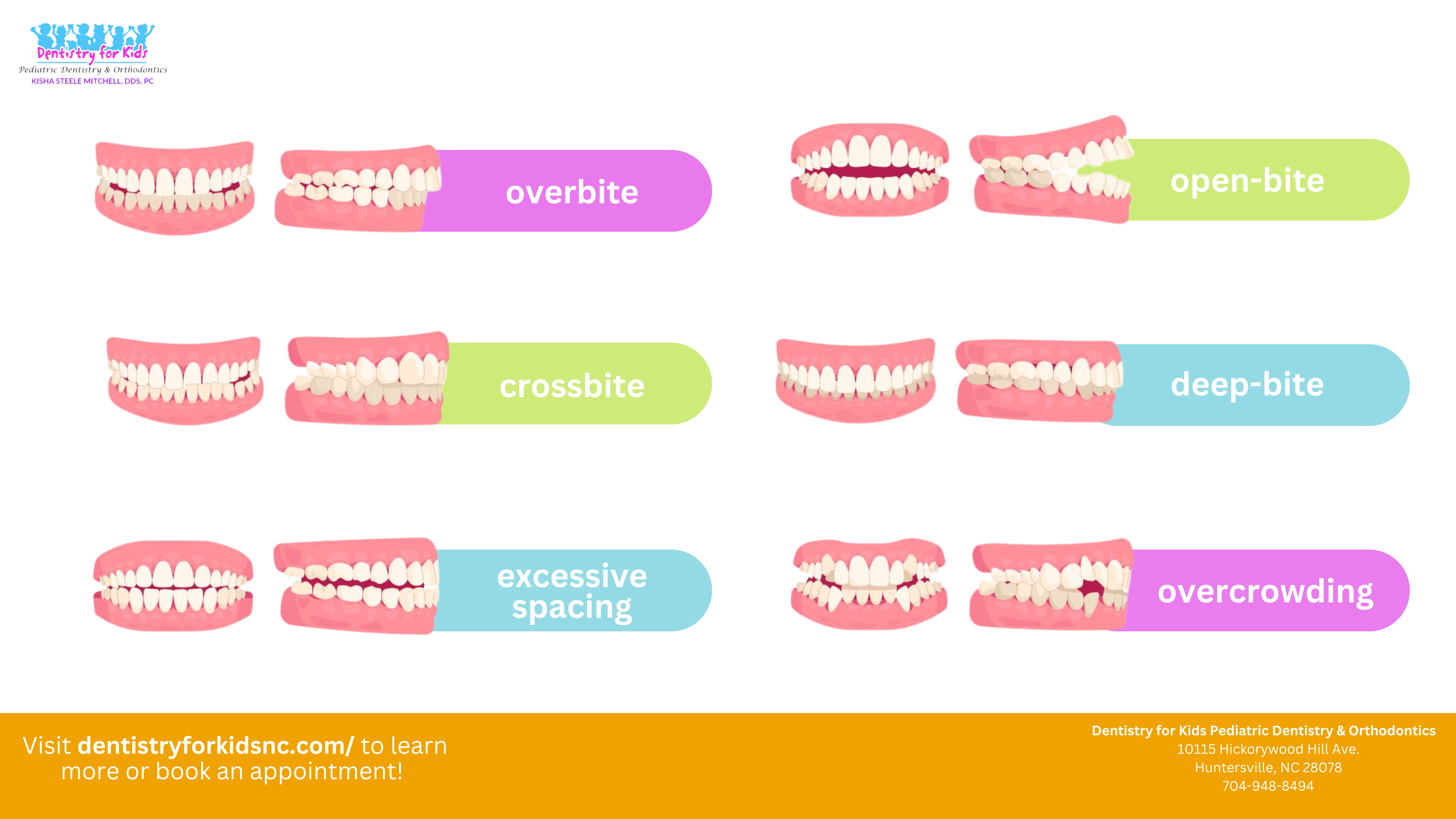 A colorful infographic showcasing different signs of needing braces by showing 6 different teeth structures, including Crowded, overlapping, or crooked teeth Overbite (upper teeth significantly overlap lower teeth) Underbite (lower teeth extend past the upper front teeth) Crossbite (upper teeth sit inside the lower teeth when biting down) Open bite (visible gap between upper and lower front teeth when the mouth is closed) Teeth that stick out (protruding teeth) Difficulty chewing or biting Mouth breathing or thumb-sucking past age 5 Early or late loss of baby teeth,